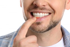 man with red, swollen gums from gum disease